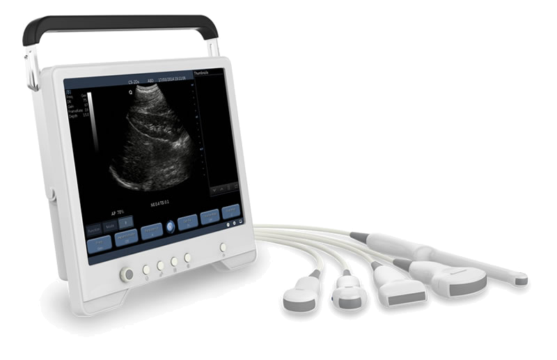 Real Time Ultra Sound Core Assessment