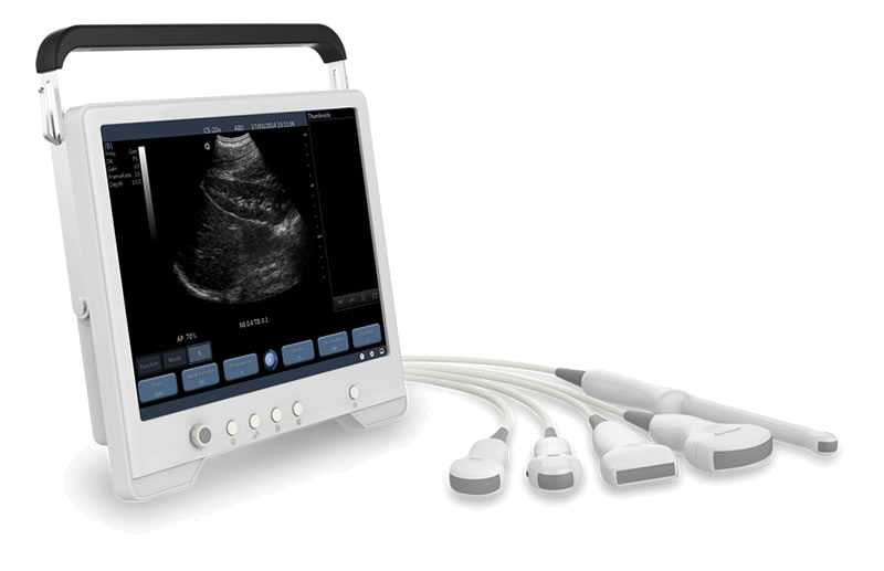 Real Time Ultra Sound Core Assessment Real Time Ultra Sound Core Assessment