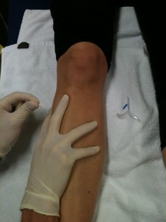 Dry Needling is a great way to decrease muscle soreness.